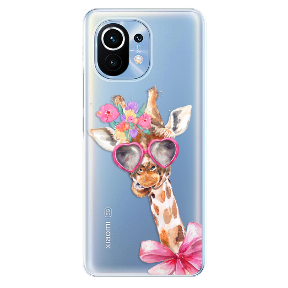 Odolné silikonové pouzdro iSaprio - Lady Giraffe - Xiaomi Mi 11