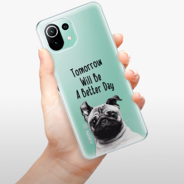 Silikonové pouzdro iSaprio - Xiaomi Mi 11 Lite / Xiaomi 11 Lite 5G NE - Better Day 01