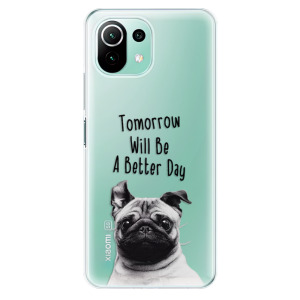 Silikonové pouzdro iSaprio - Xiaomi Mi 11 Lite / Xiaomi 11 Lite 5G NE - Better Day 01