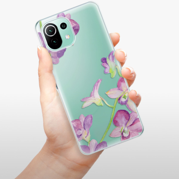 Silikonové pouzdro iSaprio - Xiaomi Mi 11 Lite / Xiaomi 11 Lite 5G NE - Purple Orchid