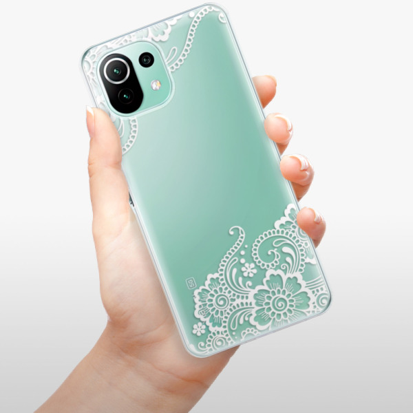 Silikonové pouzdro iSaprio - Xiaomi Mi 11 Lite / Xiaomi 11 Lite 5G NE - White Lace 02