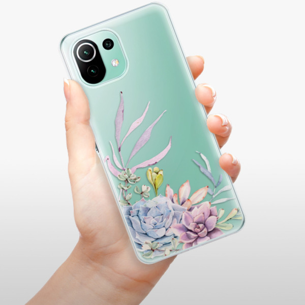 Silikonové pouzdro iSaprio - Xiaomi Mi 11 Lite / Xiaomi 11 Lite 5G NE - Succulent 01