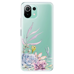 Silikonové pouzdro iSaprio - Xiaomi Mi 11 Lite / Xiaomi 11 Lite 5G NE - Succulent 01