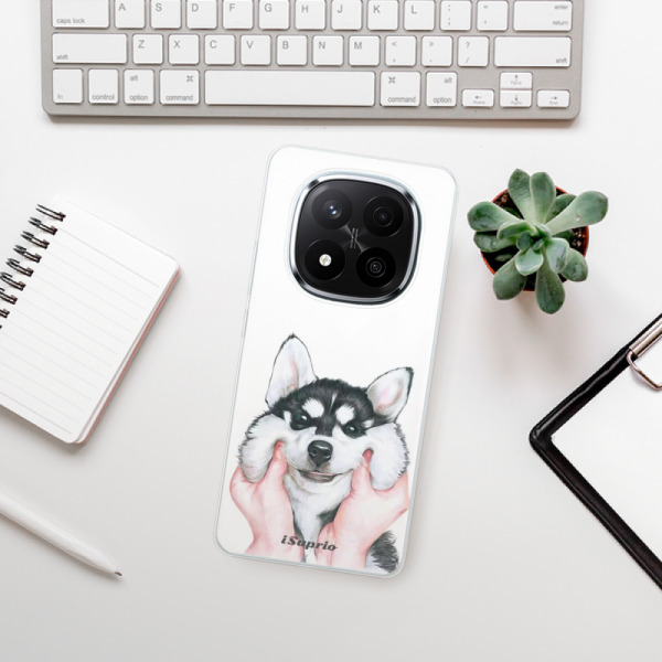 Silikonové pouzdro iSaprio - Xiaomi Redmi Note 14 Pro 5G / Note 14 Pro Plus 5G - Malamute 01
