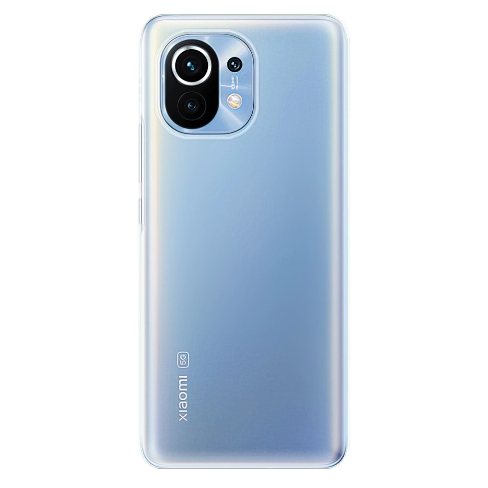 Silikonové pouzdro iSaprio s vlastním motivem na mobil Xiaomi Mi 11