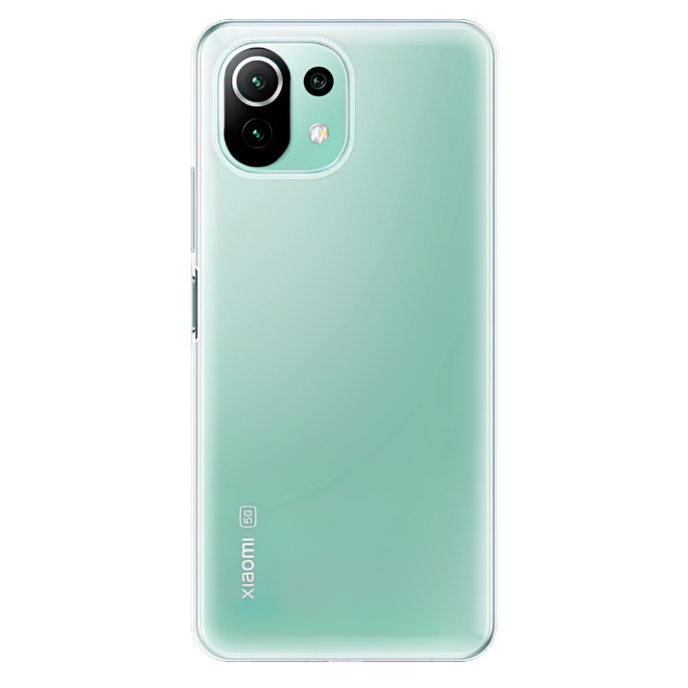Silikonové pouzdro iSaprio s vlastním motivem na mobil Xiaomi Mi 11 Lite
